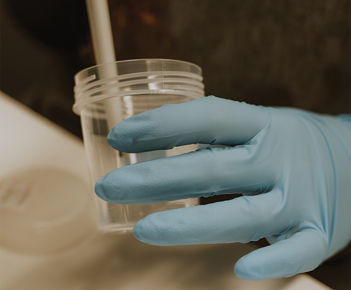 Post Vasectomy Sperm Analysis- hero Post Vasectomy Sperm Analysis